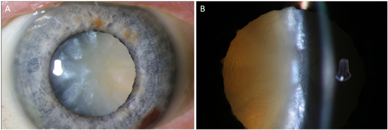 Fig. 4