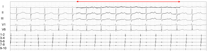 Fig. 6