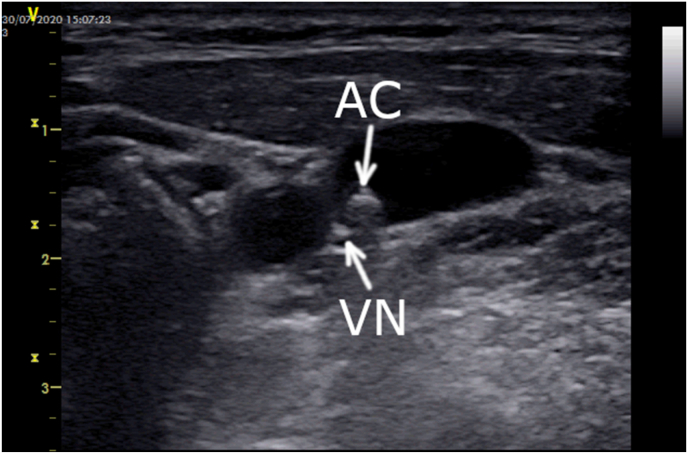 Fig. 2