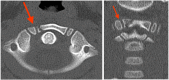 Figure 3