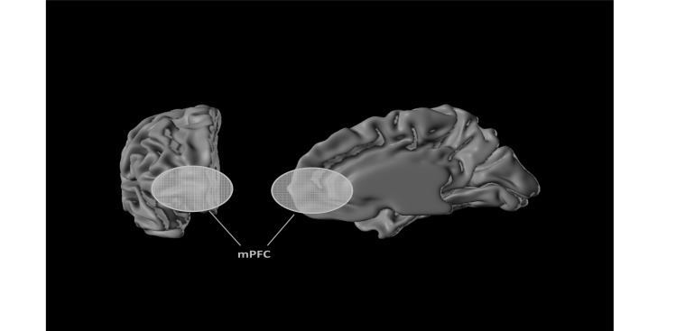 Fig. (1)