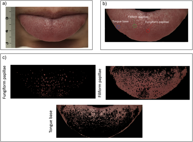 Fig. 1