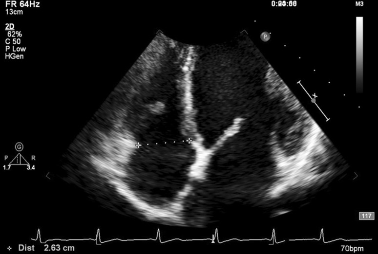 Fig. 2