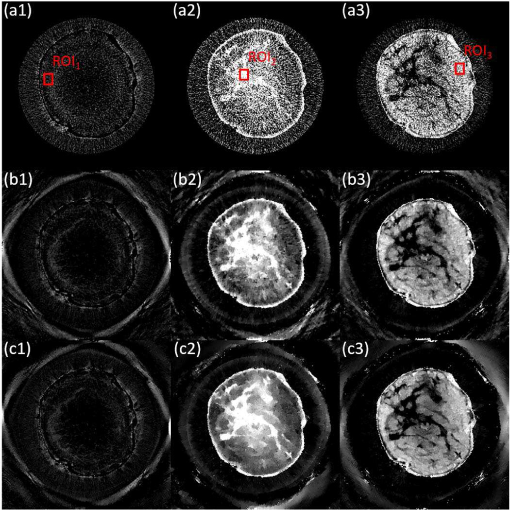 Fig. 12