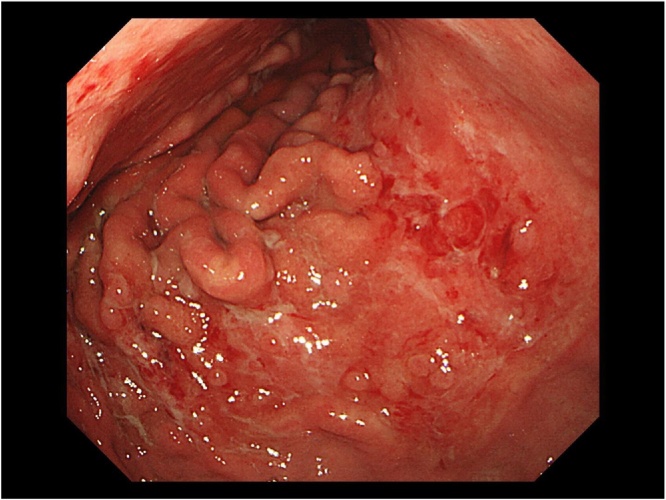 Fig. 1