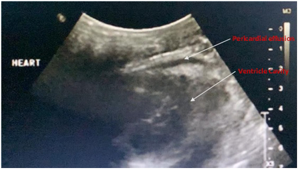 Fig 4
