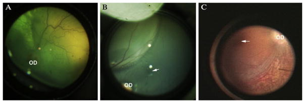 Figure 13.2