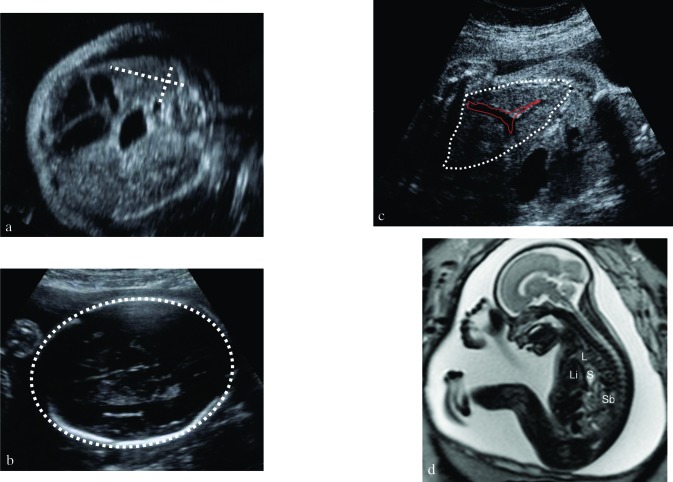 Fig. 4