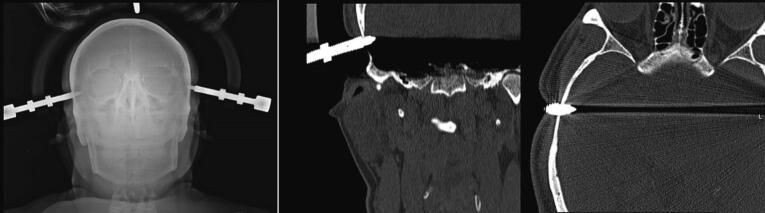 Fig. 8