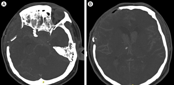 Fig. 5.