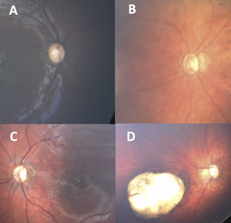 FIGURE 2