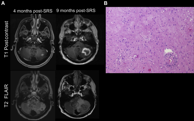 Figure 2