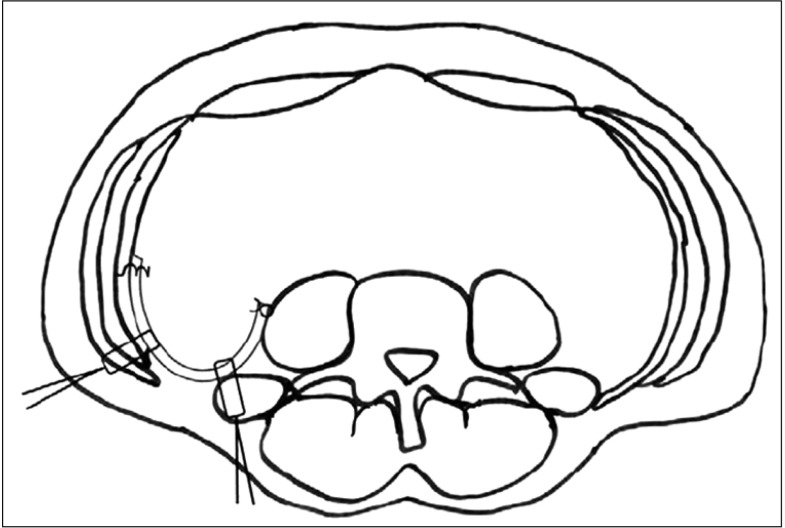 Fig. 2