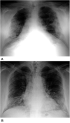 Fig. 3.