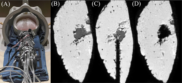 Fig. 11.