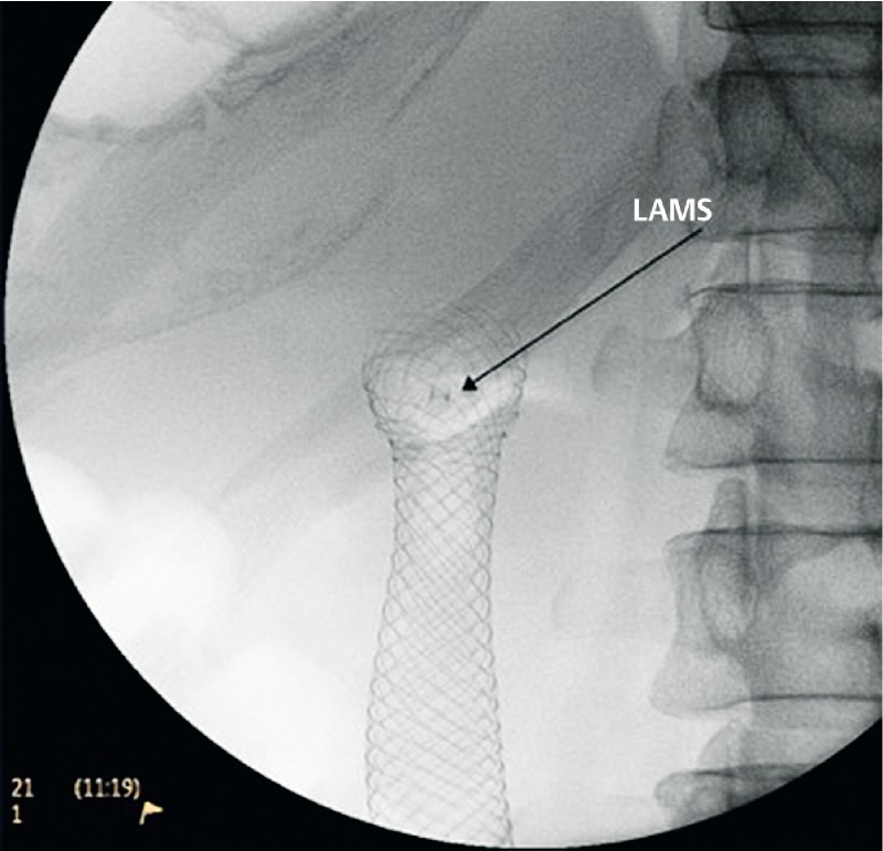 Fig. 4 