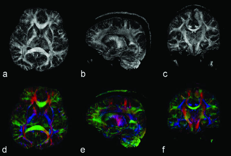 FIG. 12.