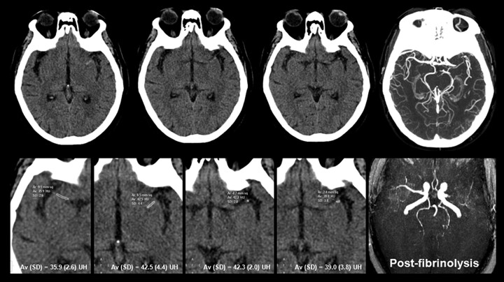 Fig 1.