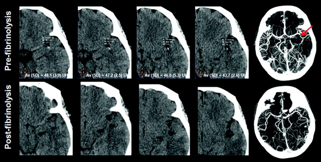 Fig 2.