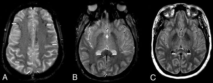 FIG 3.