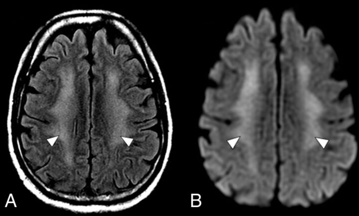 FIG 2.