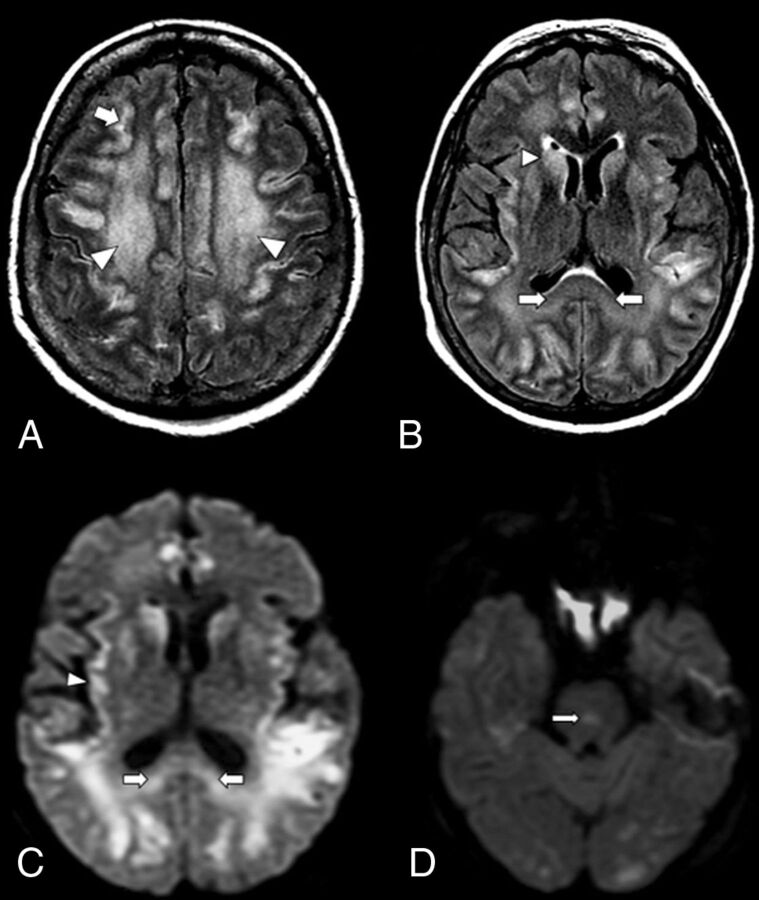 FIG 1.