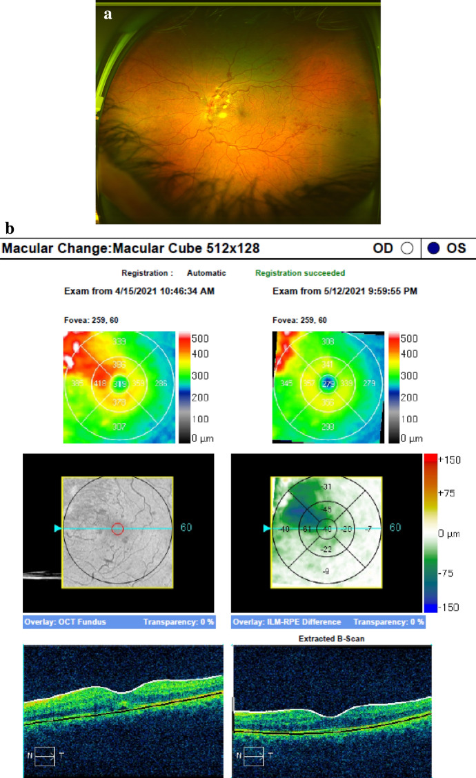 Fig. 2