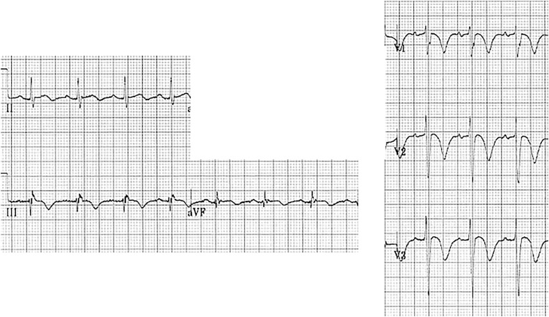 Fig. 4