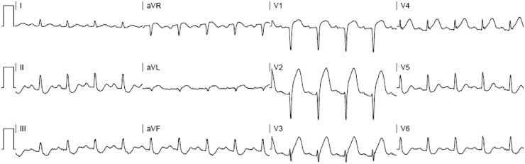 Fig. 6