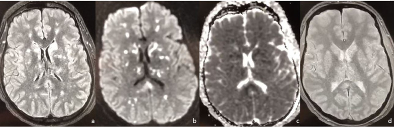 Fig 2