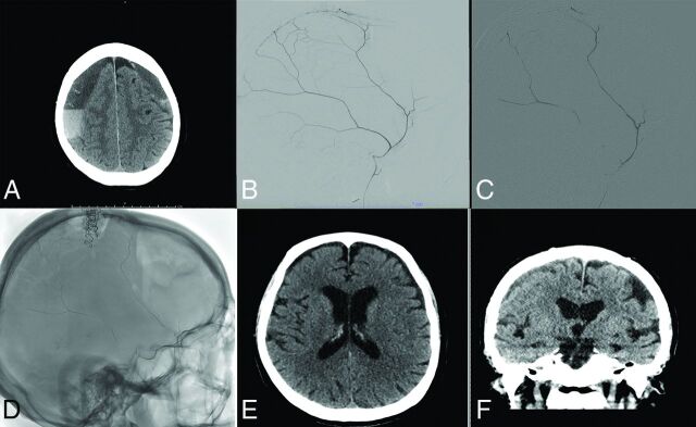 FIG 1.