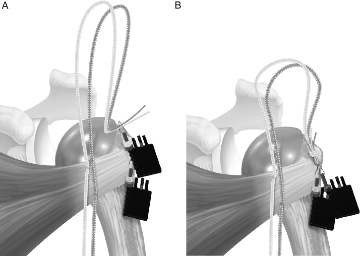 Fig 4