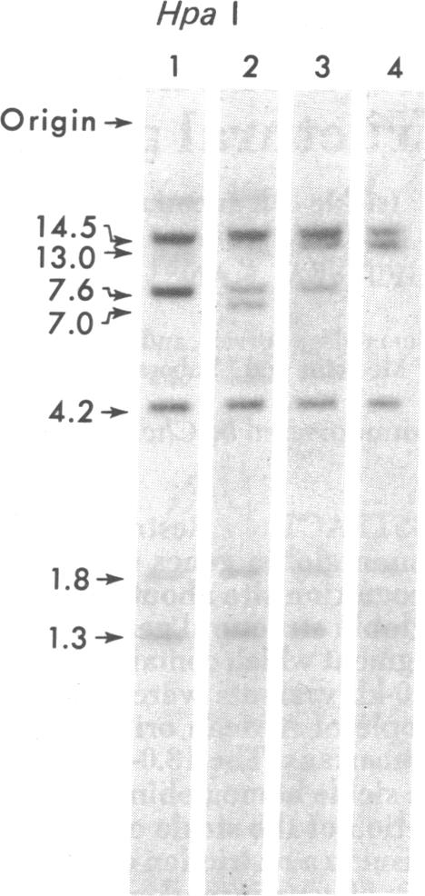 graphic file with name pnas00021-0394-a.jpg