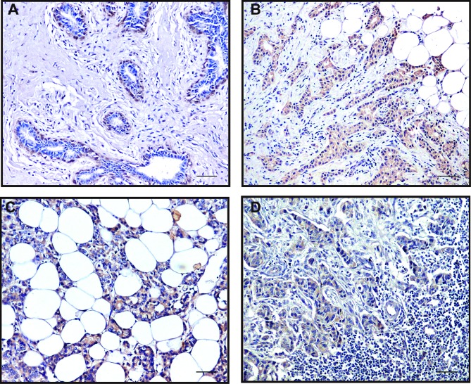 Figure 11.