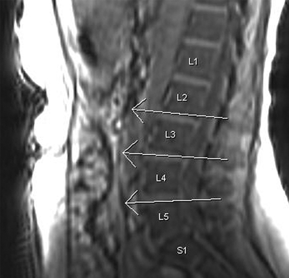 Figure 1a: