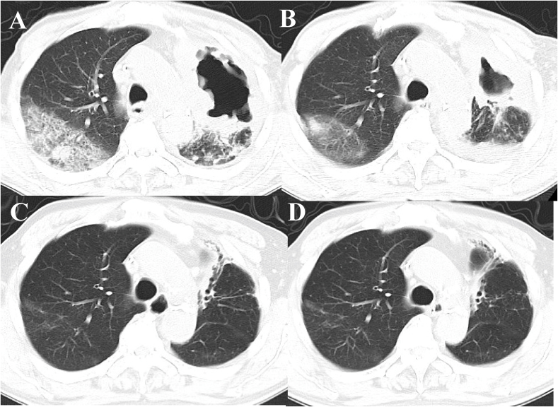 Fig. 4