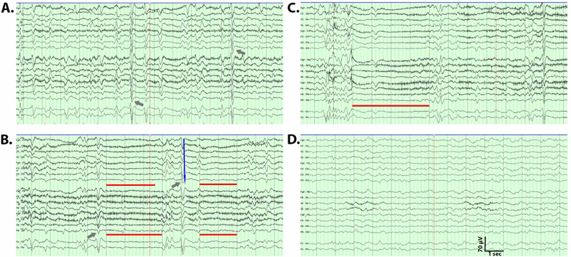 Figure 1: