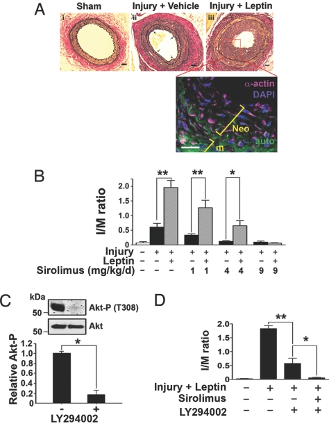 Leptin-enhanced Neointimal Hyperplasia Is Reduced By Mtor And Pi3k 