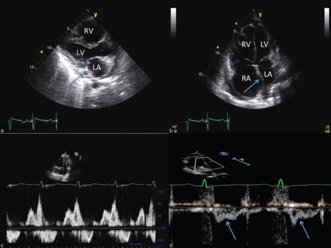 Figure 14