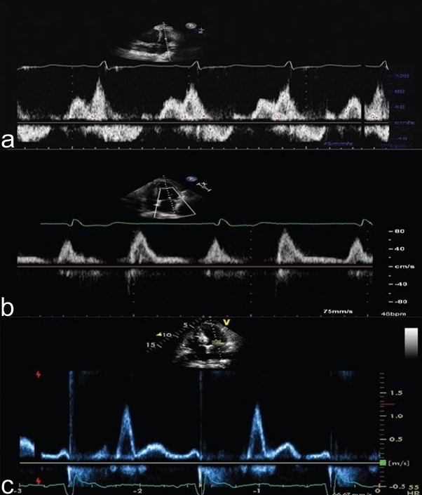 Figure 12