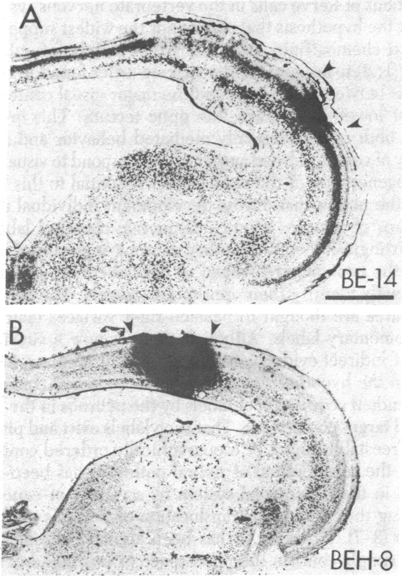 graphic file with name pnas00645-0334-b.jpg