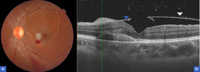 Fig. 3