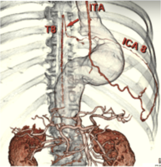 Figure 2