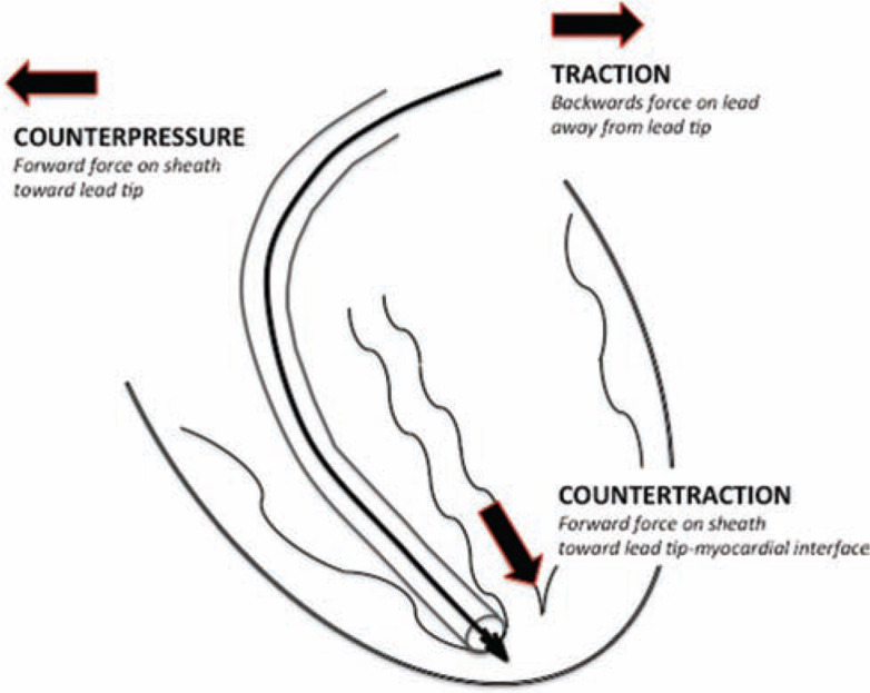 Figure 14: