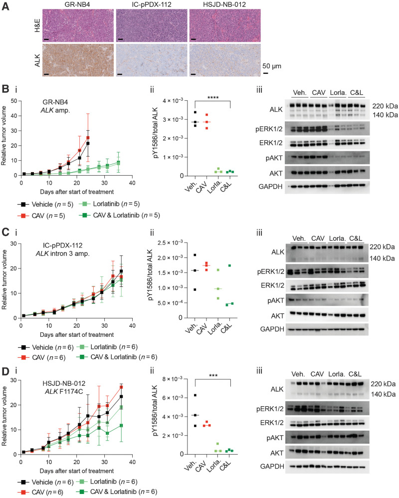 Figure 4. High baseline in vivo expression of ALK determines sensitivity to lorlatinib in an ALK-amplified PDX neuroblastoma model. A, Hematoxylin and Eosin (H&E) and ALK IHC staining of vehicle-treated tumors from indicated PDX models, treated for 3 days. GR-NB4 (B), IC-pPDX-112 (C), and HSJD-NB-012 (D) PDX models were treated with vehicle control, one dose of chemotherapy (CAV: Cyclophosphamide, doxorubicin, and vincristine), continuous lorlatinib, or chemotherapy and continuous lorlatinib combination. I, Tumor volumes were monitored during treatment. (ii) pY1586/total ALK measured by immunoassay in tumor lysates taken at the end of the experiment (mean of two technical replicates; Veh.: vehicle; Lorla.: Lorlatinib; C&L: CAV and lorlatinib). One-way ANOVA: B.ii: P < 0.0001; C.ii: not significant; D.ii: P = 0.0010 (iii) Immunoblots of signaling pathways downstream of ALK from tumor lysates as per (ii).