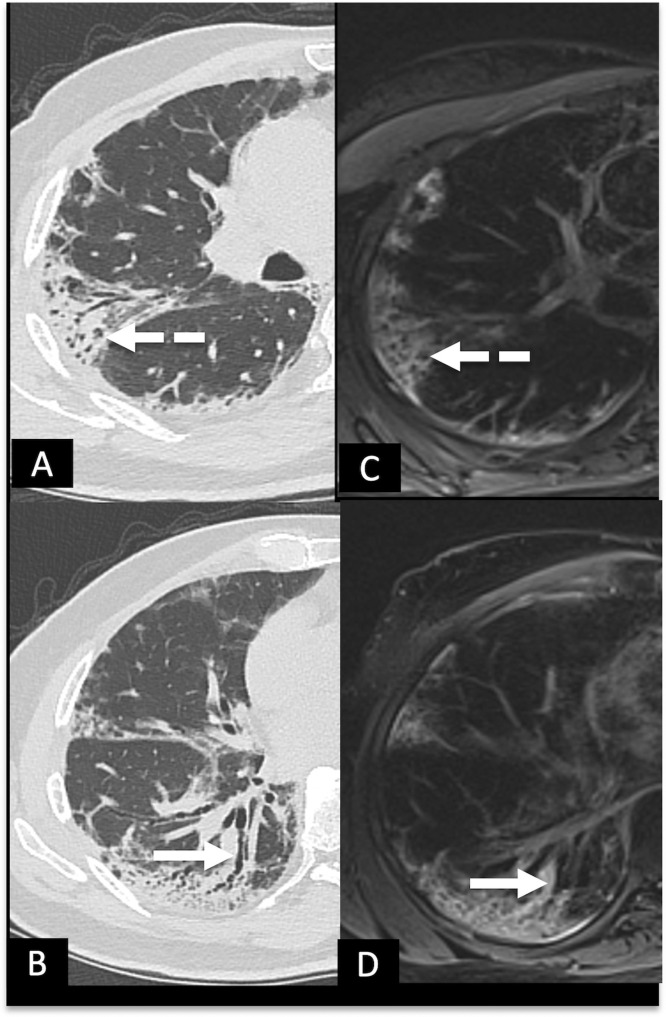 FIG 6