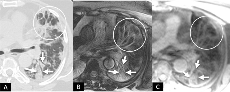 FIG 4