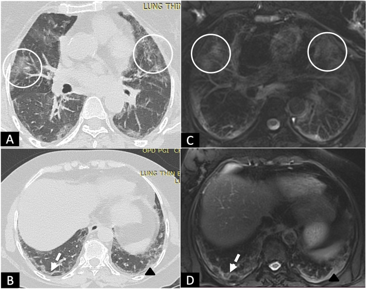 FIG 2