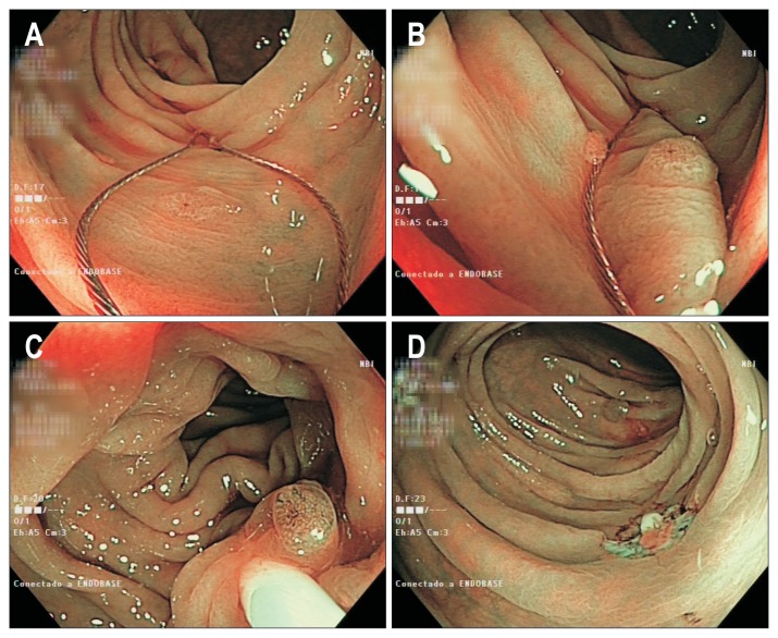 Fig. 4