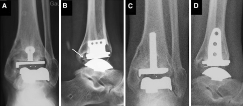 Fig. 6A–D